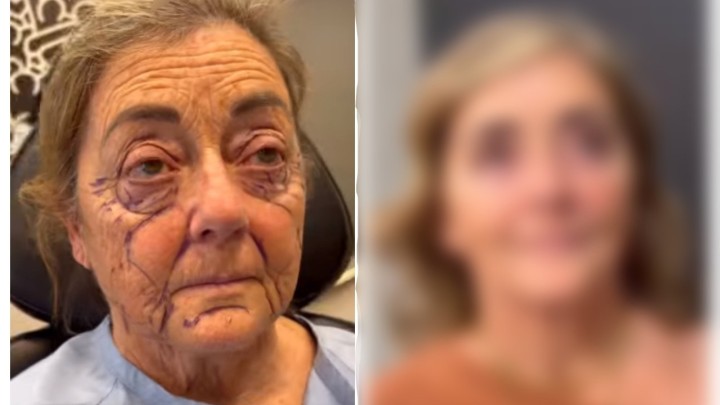 Kakva preobrazba: Podvrgnula se plastičnim operacijama, pogledajte kako sada izgleda