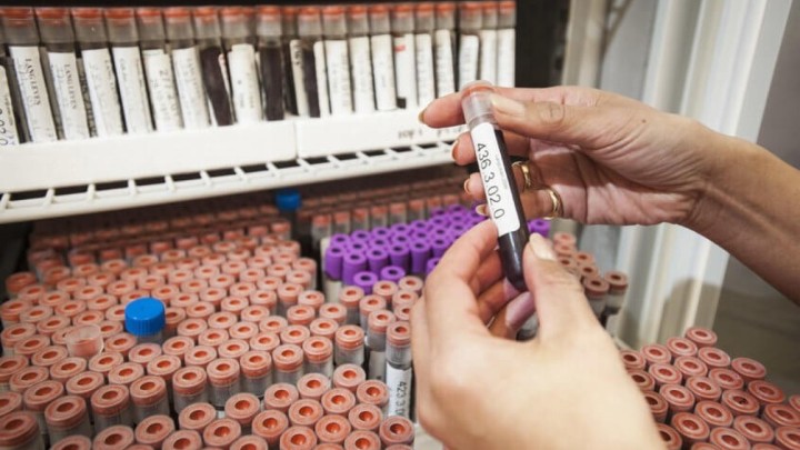 Starenje pod povećalom: Znanstvenici će analizom krvi saznati naš 'rok trajanja'?