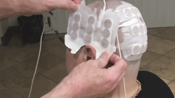 Elektrošokovima umirovljenicima povratili moć pamćenja na razinu 20-godišnjaka