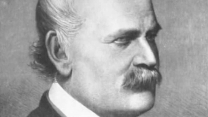 [13.8.] Preminuo "spasitelj majki", doktor kojeg su strpali u umobolnicu jer je inzistirao da ljudi moraju prati ruke